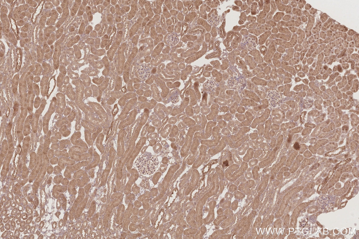 Immunohistochemistry (IHC) staining of mouse kidney tissue using DUSP16 Polyclonal antibody (14237-1-AP)