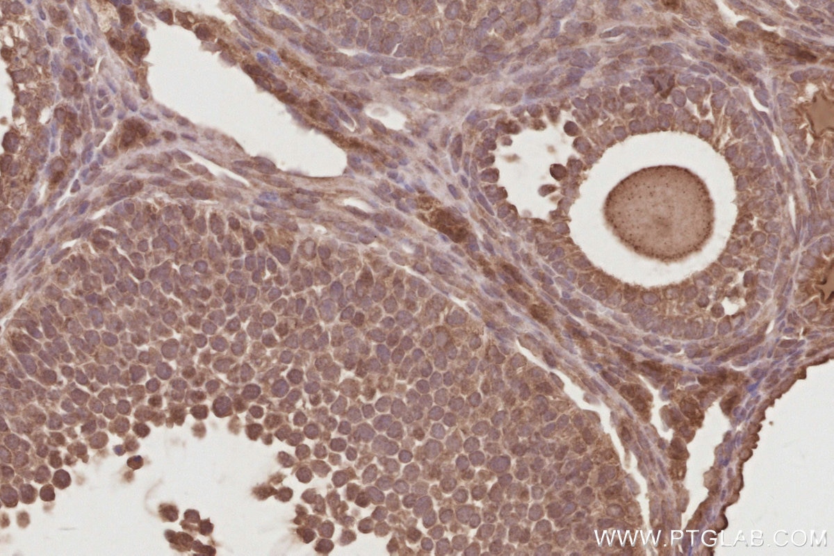 Immunohistochemistry (IHC) staining of mouse ovary tissue using DUSP16 Polyclonal antibody (14237-1-AP)