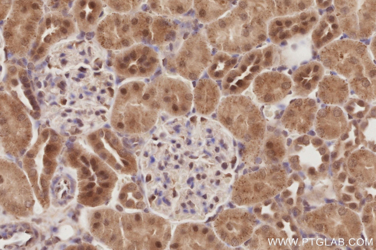 Immunohistochemistry (IHC) staining of rat kidney tissue using DUSP16 Polyclonal antibody (14237-1-AP)