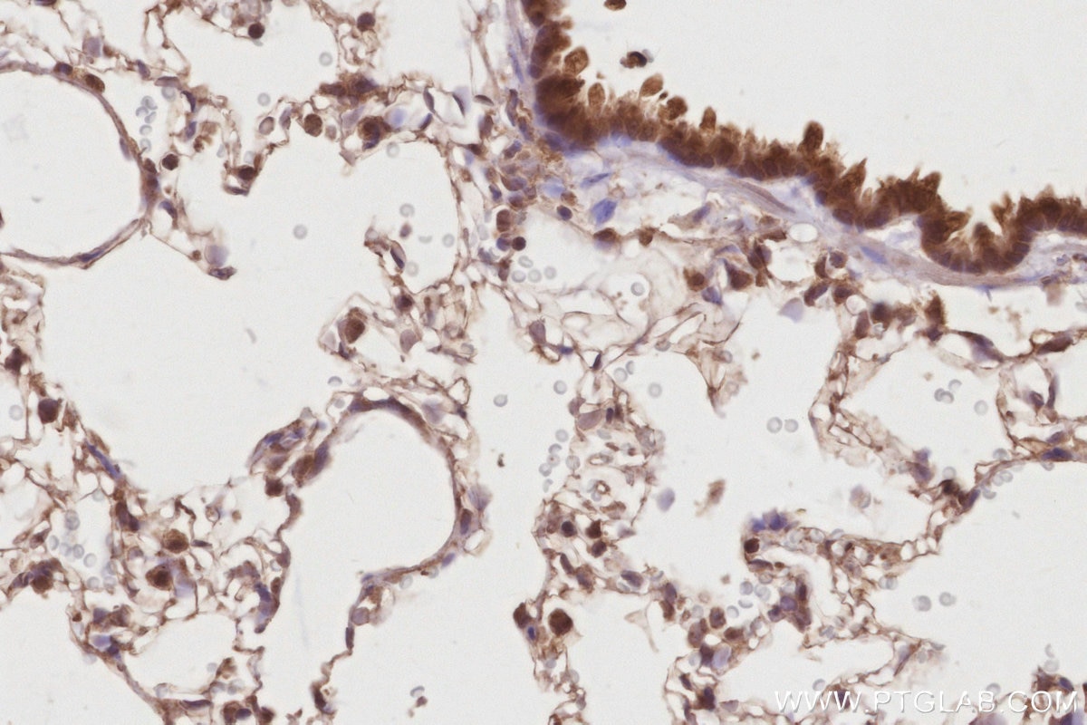 Immunohistochemistry (IHC) staining of rat lung tissue using DUSP16 Polyclonal antibody (14237-1-AP)