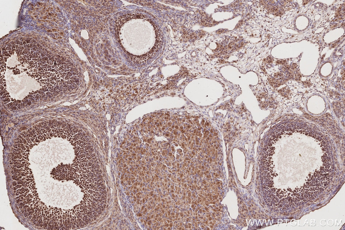 Immunohistochemistry (IHC) staining of rat ovary tissue using DUSP16 Polyclonal antibody (14237-1-AP)