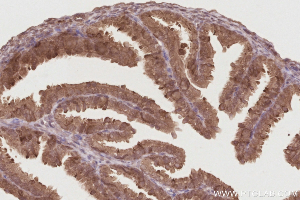 Immunohistochemistry (IHC) staining of mouse ovary tissue using DUSP16 Polyclonal antibody (14237-1-AP)