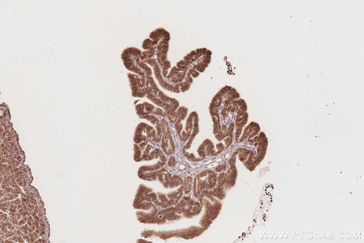 Immunohistochemistry (IHC) staining of rat ovary tissue using DUSP16 Polyclonal antibody (14237-1-AP)