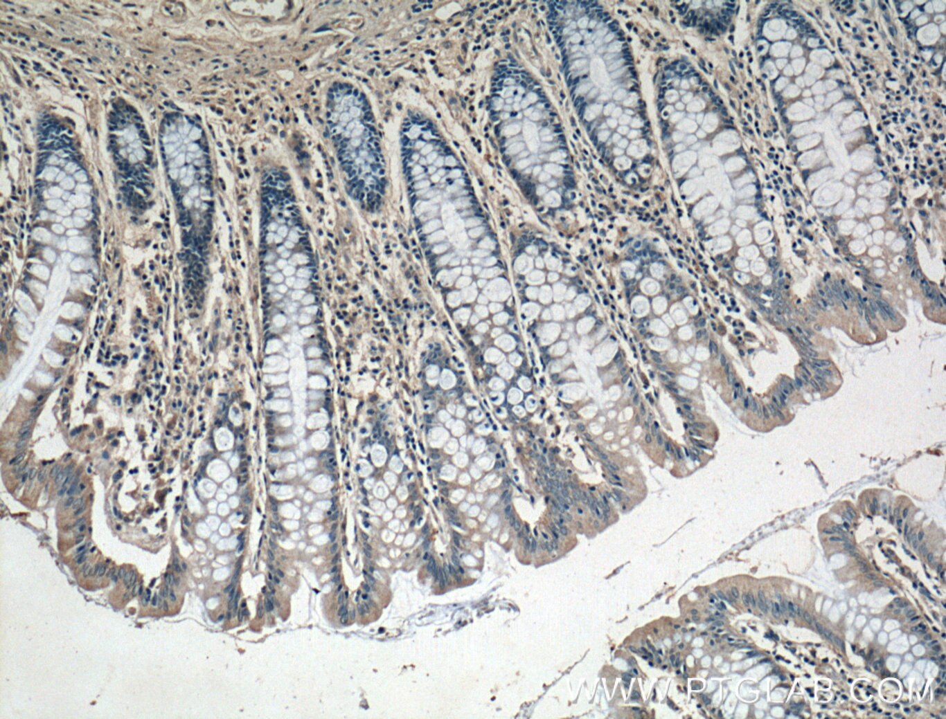 Immunohistochemistry (IHC) staining of human colon tissue using DUSP16 Polyclonal antibody (14237-1-AP)