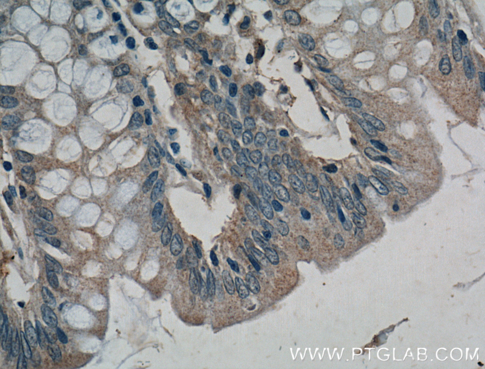 Immunohistochemistry (IHC) staining of human colon tissue using DUSP16 Polyclonal antibody (14237-1-AP)