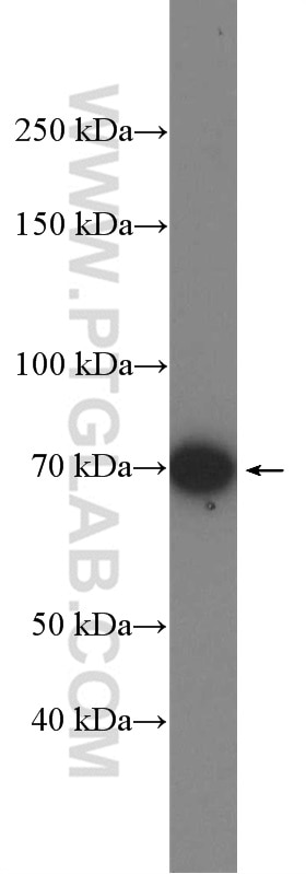 Western Blot (WB) analysis of HeLa cells using DUSP16 Polyclonal antibody (14237-1-AP)