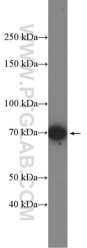 WB analysis of HeLa using 14237-1-AP