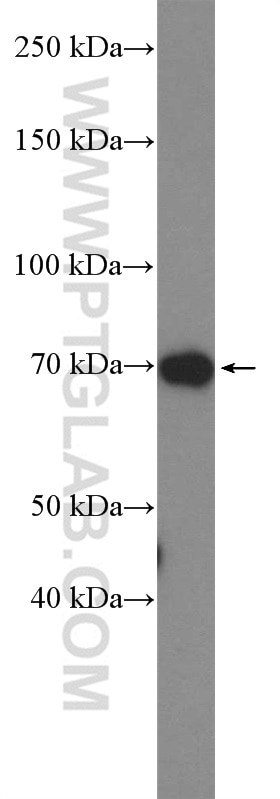 Western Blot (WB) analysis of COLO 320 cells using DUSP16 Polyclonal antibody (14237-1-AP)
