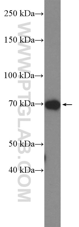 WB analysis of COLO 320 using 14237-1-AP