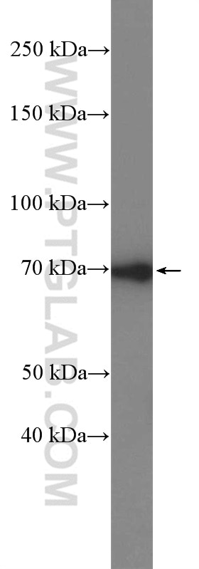 Western Blot (WB) analysis of mouse brain tissue using DUSP16 Polyclonal antibody (14237-1-AP)