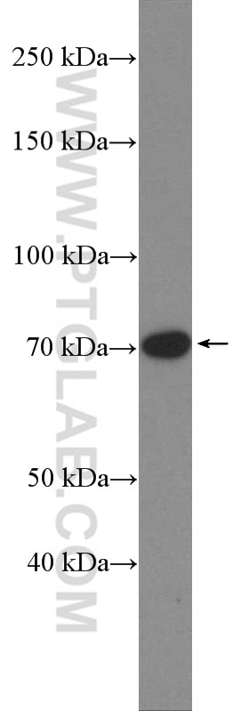 Western Blot (WB) analysis of PC-12 cells using DUSP16 Polyclonal antibody (14237-1-AP)