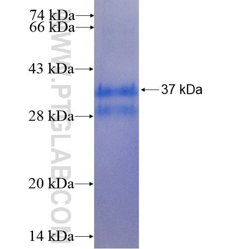 DUSP18 fusion protein Ag5704 SDS-PAGE