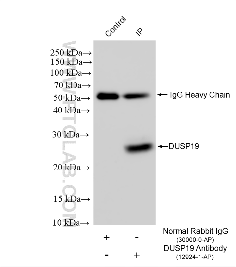 IP result of anti-DUSP19 (IP:12924-1-AP, 4ug; Detection:12924-1-AP 1:1000) with mouse lung tissue lysate 1240 ug. Immunoprecipitation (IP) experiment of mouse lung tissue using DUSP19 Polyclonal antibody (12924-1-AP)