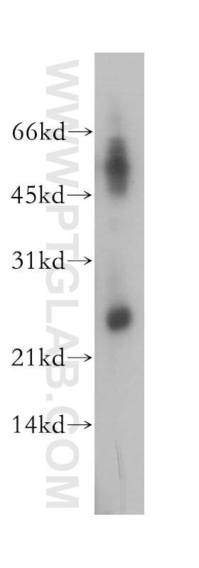Western Blot (WB) analysis of mouse uterus tissue using DUSP19 Polyclonal antibody (12924-1-AP)