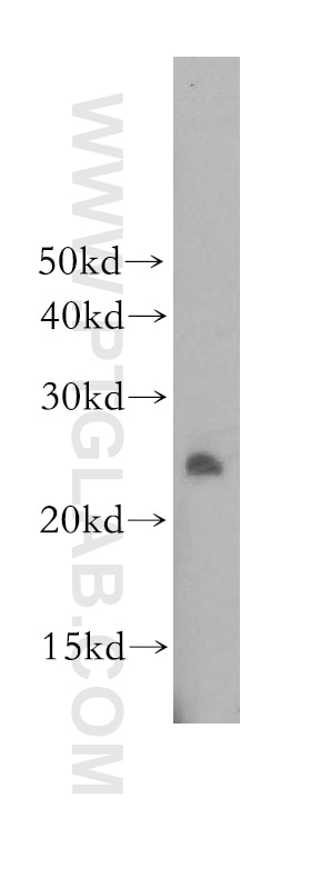 Western Blot (WB) analysis of mouse lung tissue using DUSP19 Polyclonal antibody (12924-1-AP)