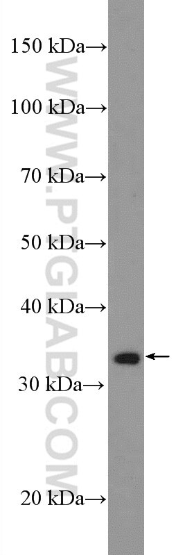 Western Blot (WB) analysis of A549 cells using DUSP2 Polyclonal antibody (27327-1-AP)