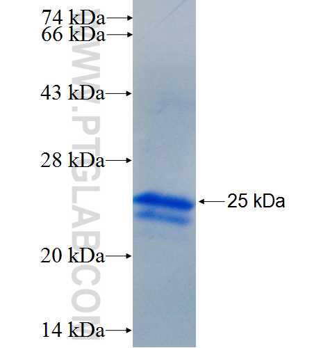DUSP2 fusion protein Ag25380 SDS-PAGE