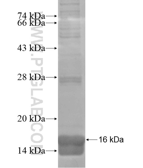 DUSP21 fusion protein Ag18636 SDS-PAGE