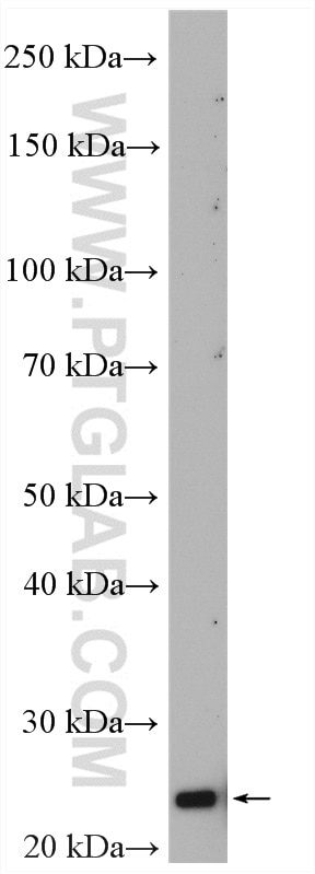 Western Blot (WB) analysis of mouse kidney tissue using DUSP22 Polyclonal antibody (16514-1-AP)