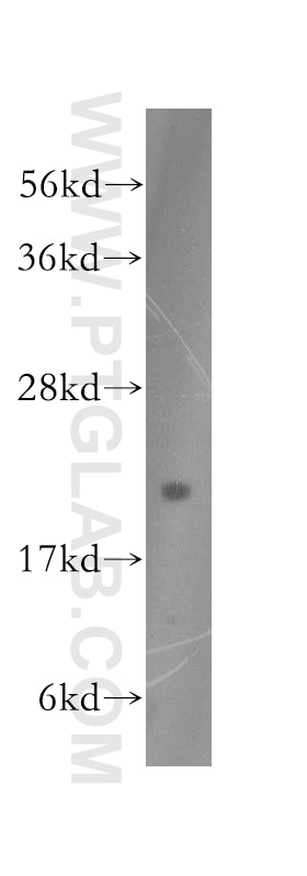Western Blot (WB) analysis of HEK-293 cells using DUSP22 Polyclonal antibody (51005-2-AP)
