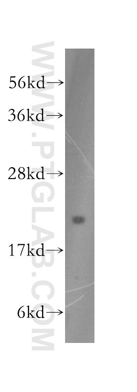 WB analysis of HEK-293 using 51005-2-AP