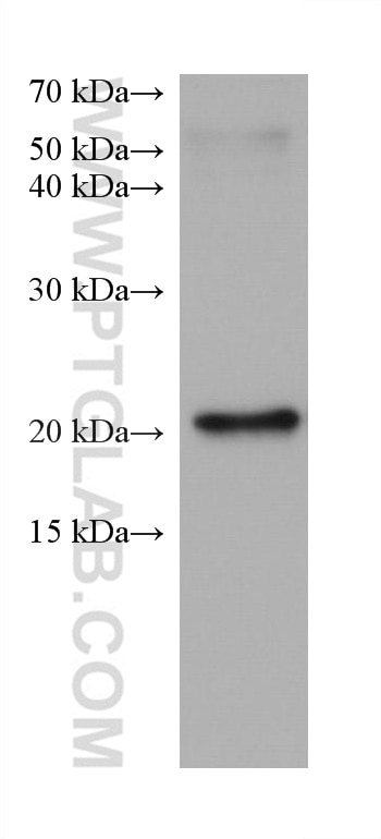 Western Blot (WB) analysis of rabbit brain tissue using DUSP22 Monoclonal antibody (68032-1-Ig)