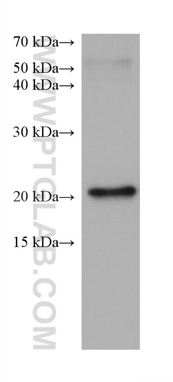 Western Blot (WB) analysis of rabbit brain tissue using DUSP22 Monoclonal antibody (68032-1-Ig)