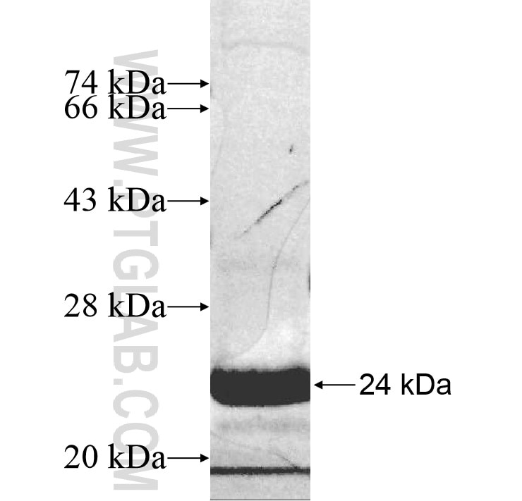 DUSP22 fusion protein Ag9831 SDS-PAGE
