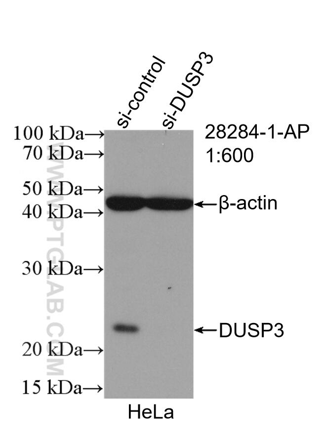 Western Blot (WB) analysis of HeLa cells using DUSP3 Polyclonal antibody (28284-1-AP)