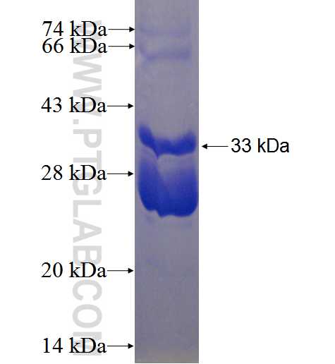 DUSP3 fusion protein Ag0853 SDS-PAGE