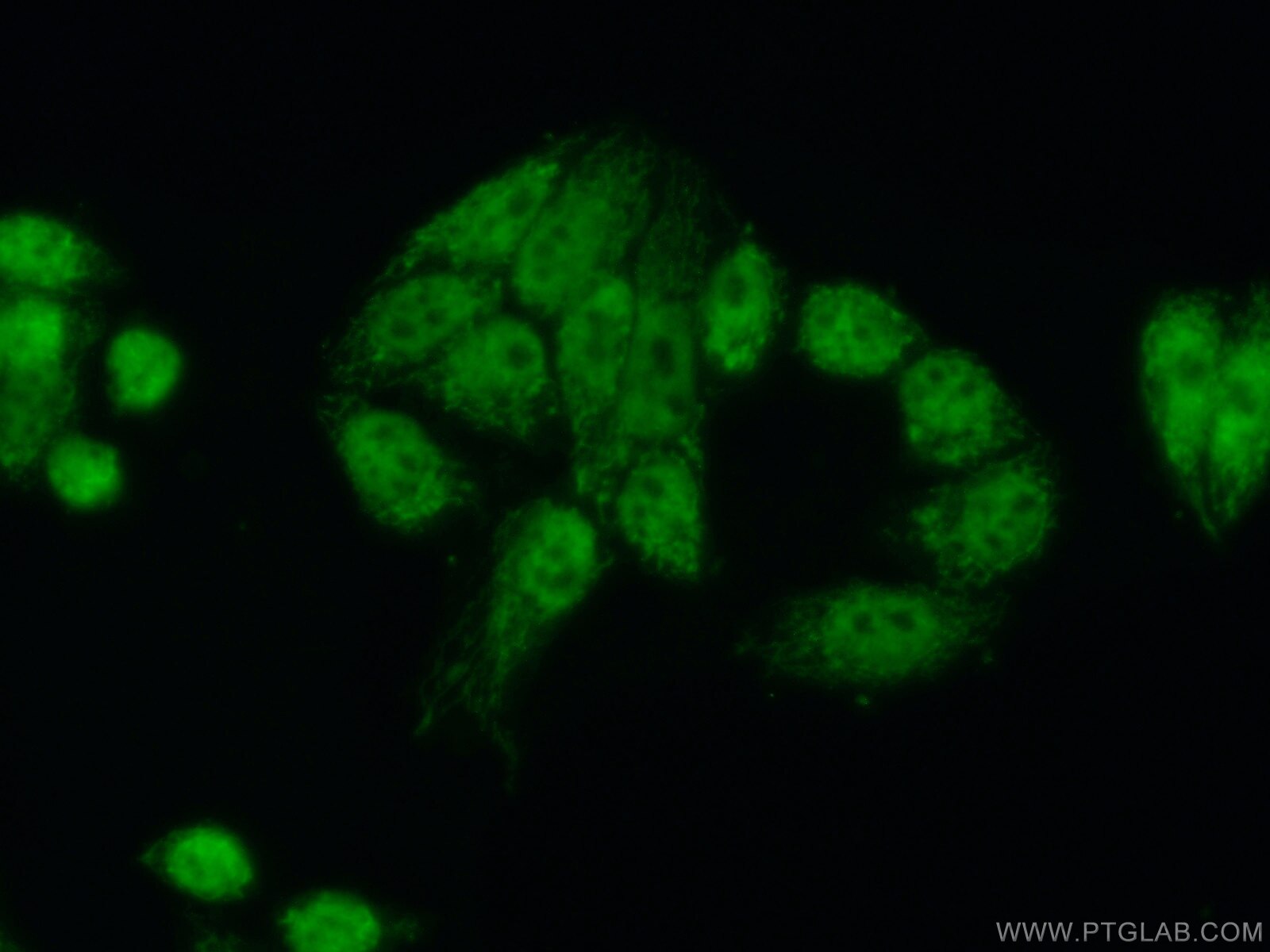 MKP-2/DUSP4