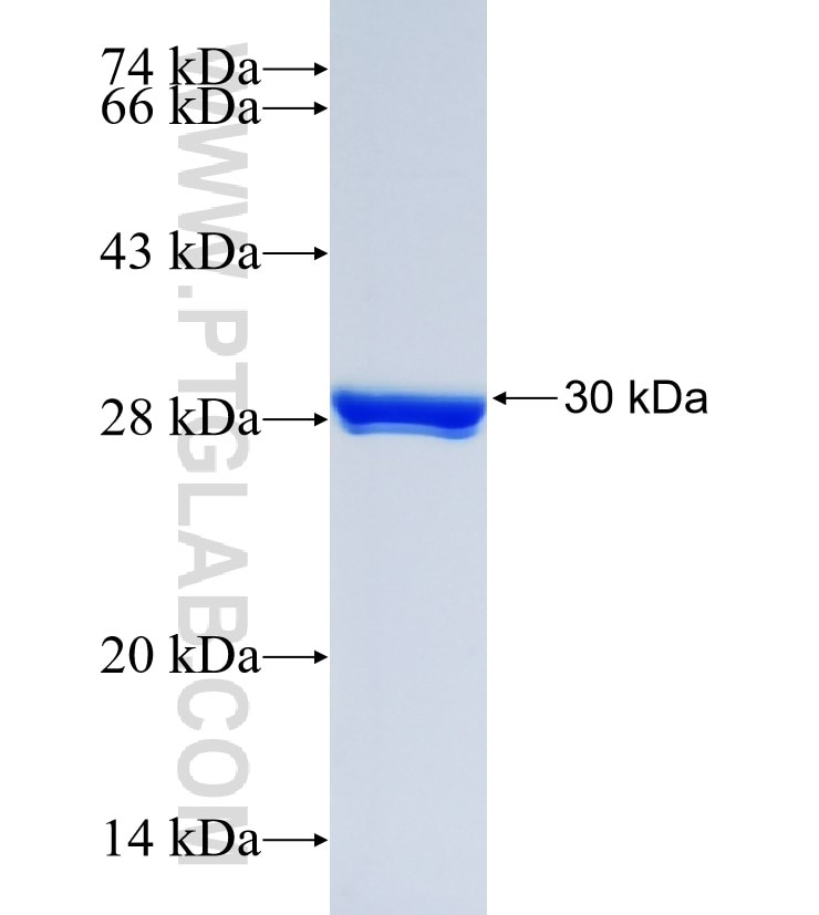 DUSP6 fusion protein Ag23474 SDS-PAGE