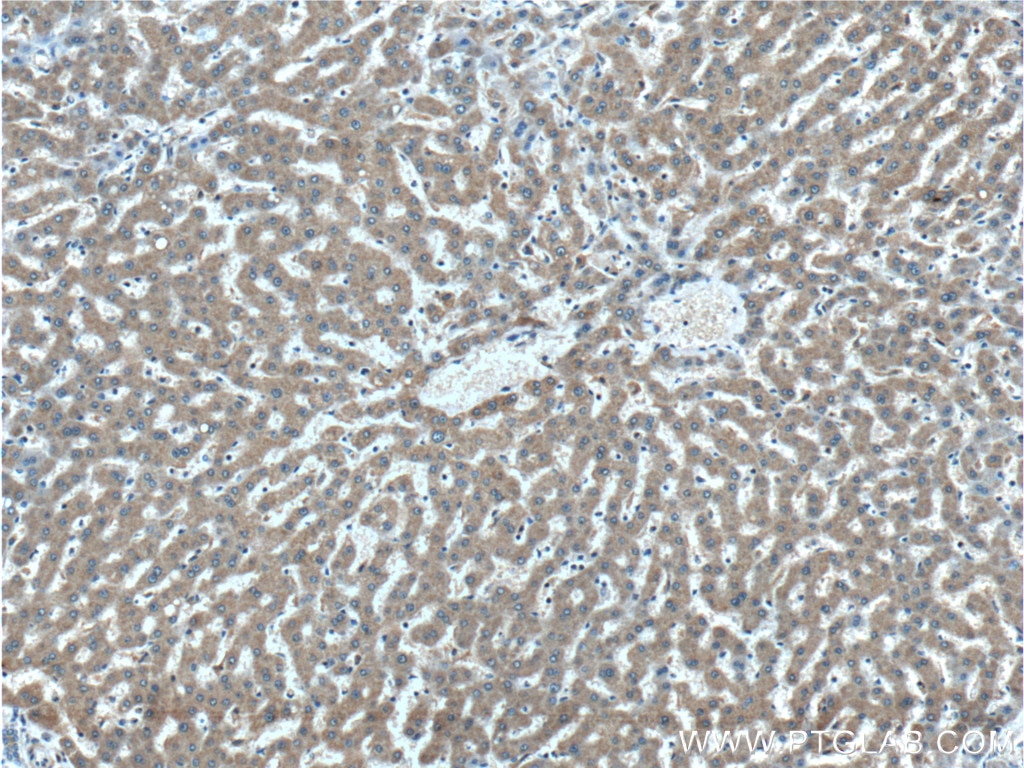 IHC staining of human liver using 26910-1-AP