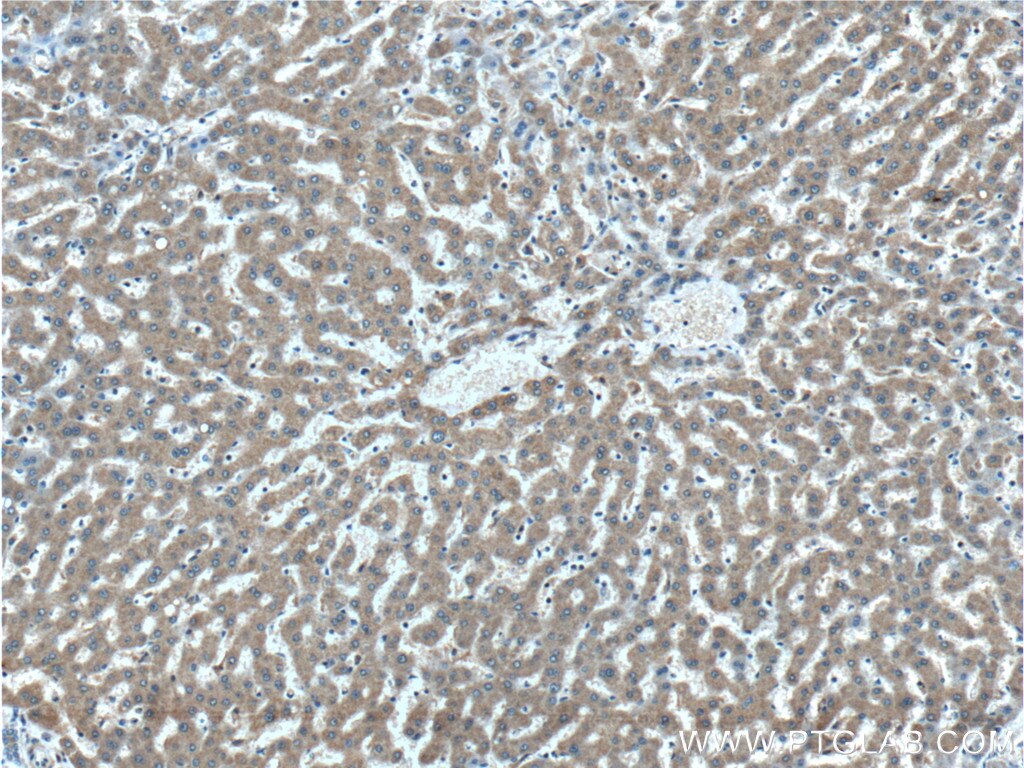 Immunohistochemistry (IHC) staining of human liver tissue using DUSP7/PYST2 Polyclonal antibody (26910-1-AP)