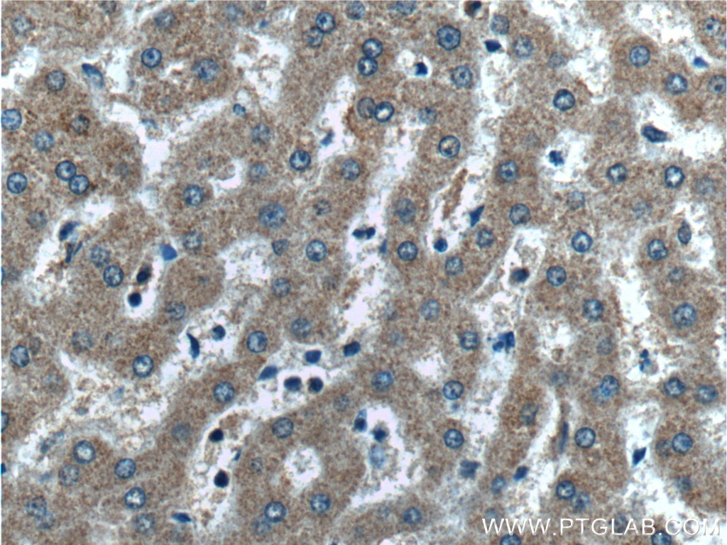 Immunohistochemistry (IHC) staining of human liver tissue using DUSP7/PYST2 Polyclonal antibody (26910-1-AP)