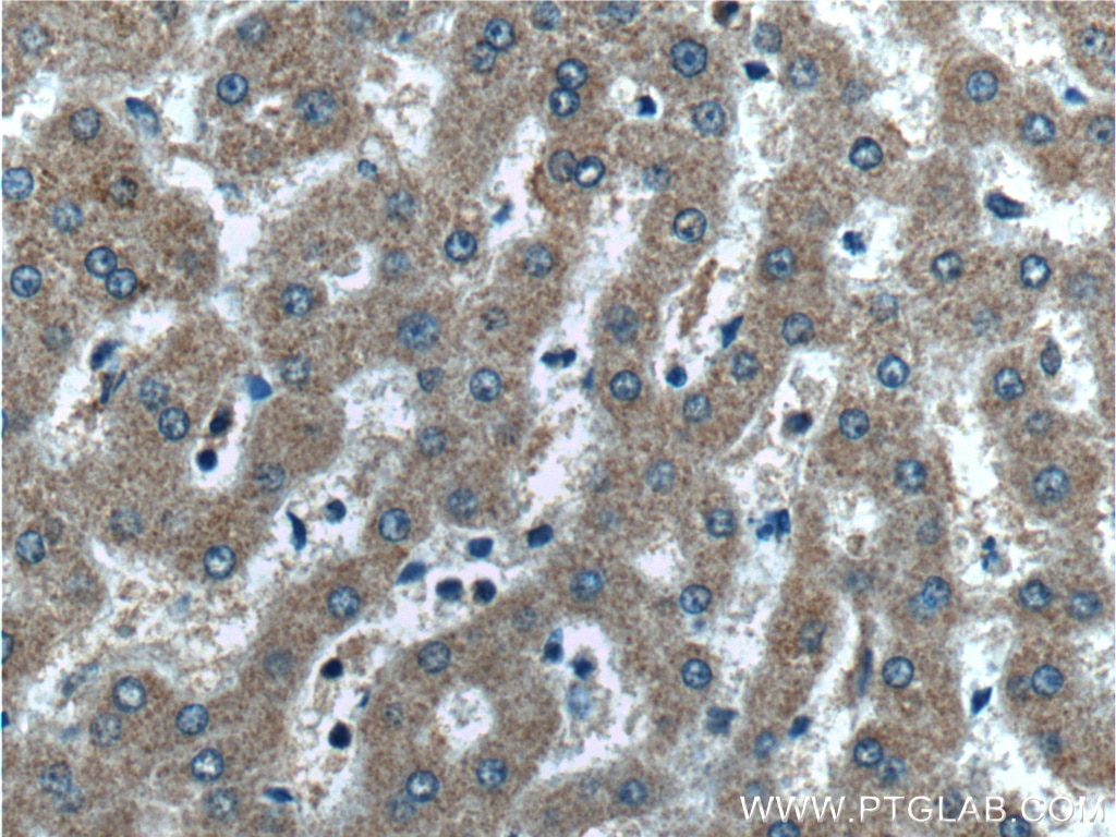 IHC staining of human liver using 26910-1-AP