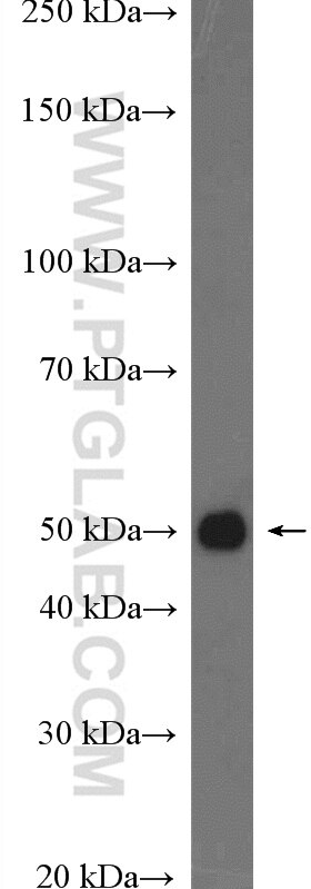 Western Blot (WB) analysis of mouse kidney tissue using DUSP7/PYST2 Polyclonal antibody (26910-1-AP)