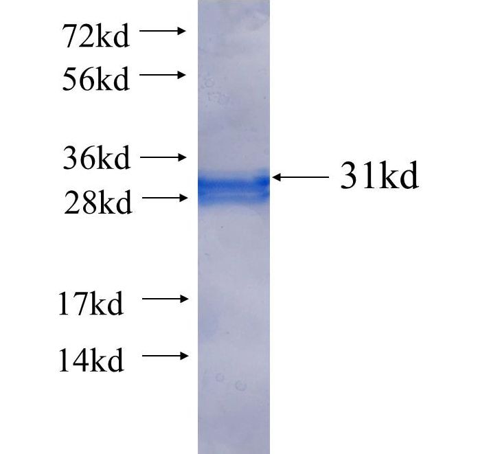 DUSP7 fusion protein Ag25488 SDS-PAGE