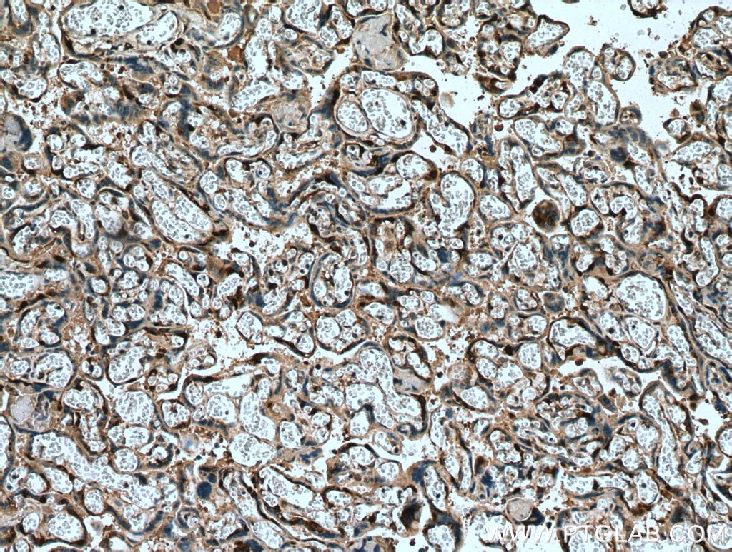 Immunohistochemistry (IHC) staining of human placenta tissue using DUSP9 Polyclonal antibody (26718-1-AP)