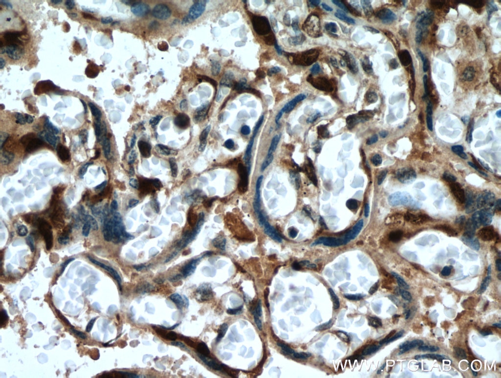 IHC staining of human placenta using 26718-1-AP