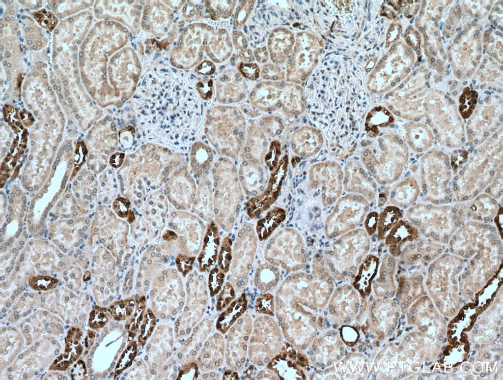 Immunohistochemistry (IHC) staining of human kidney tissue using DUSP9 Polyclonal antibody (26718-1-AP)