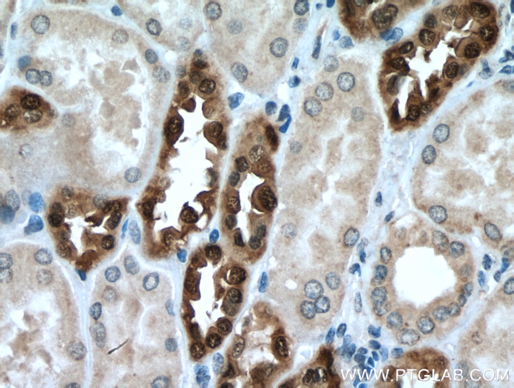 IHC staining of human kidney using 26718-1-AP