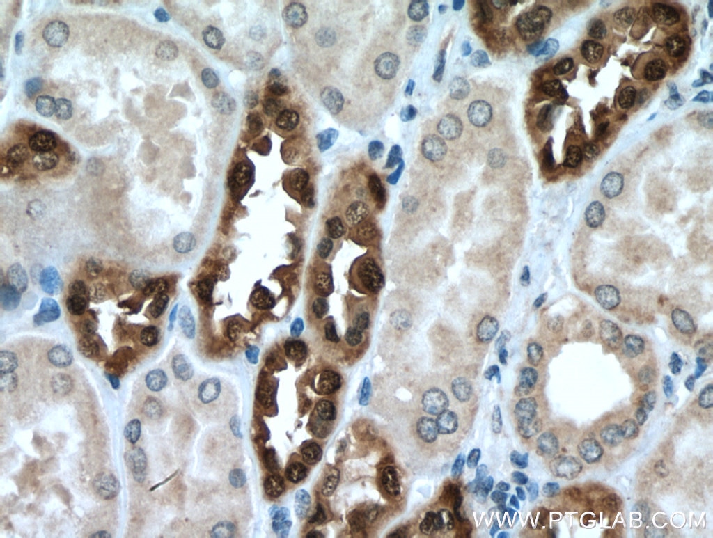 Immunohistochemistry (IHC) staining of human kidney tissue using DUSP9 Polyclonal antibody (26718-1-AP)