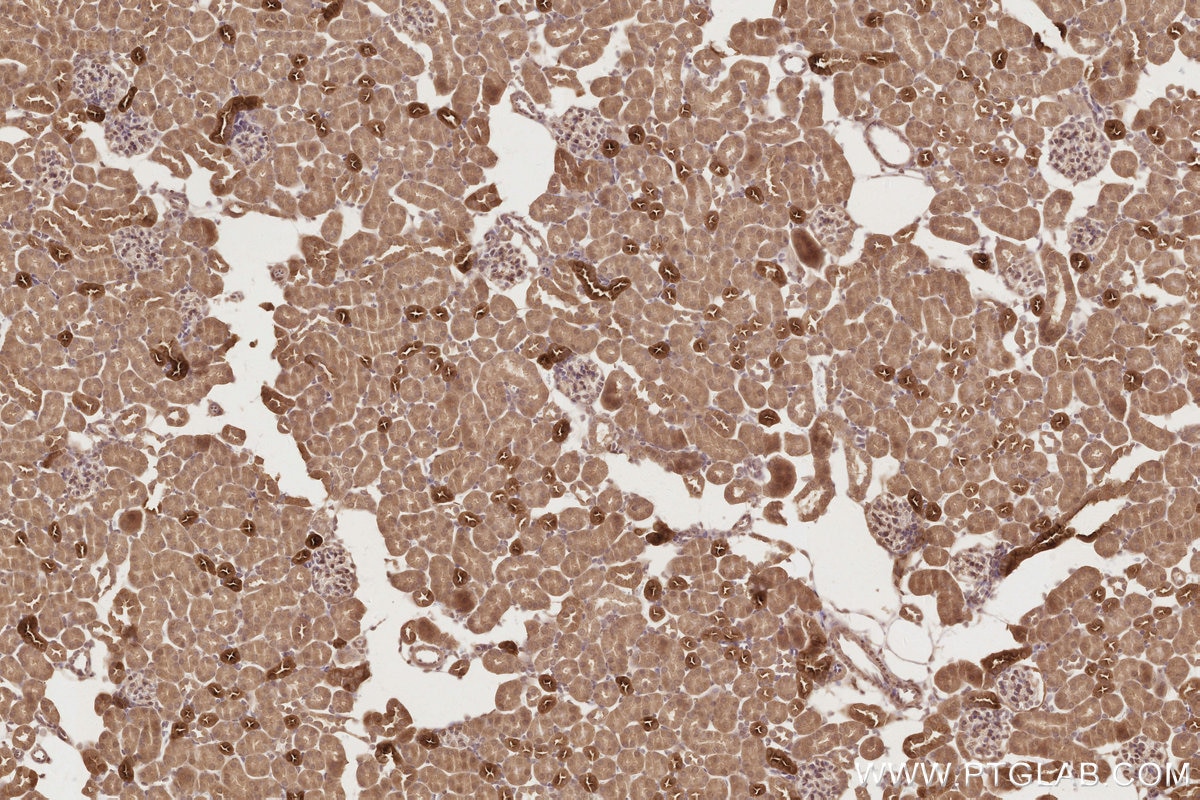 Immunohistochemistry (IHC) staining of mouse kidney tissue using DUSP9 Polyclonal antibody (26718-1-AP)