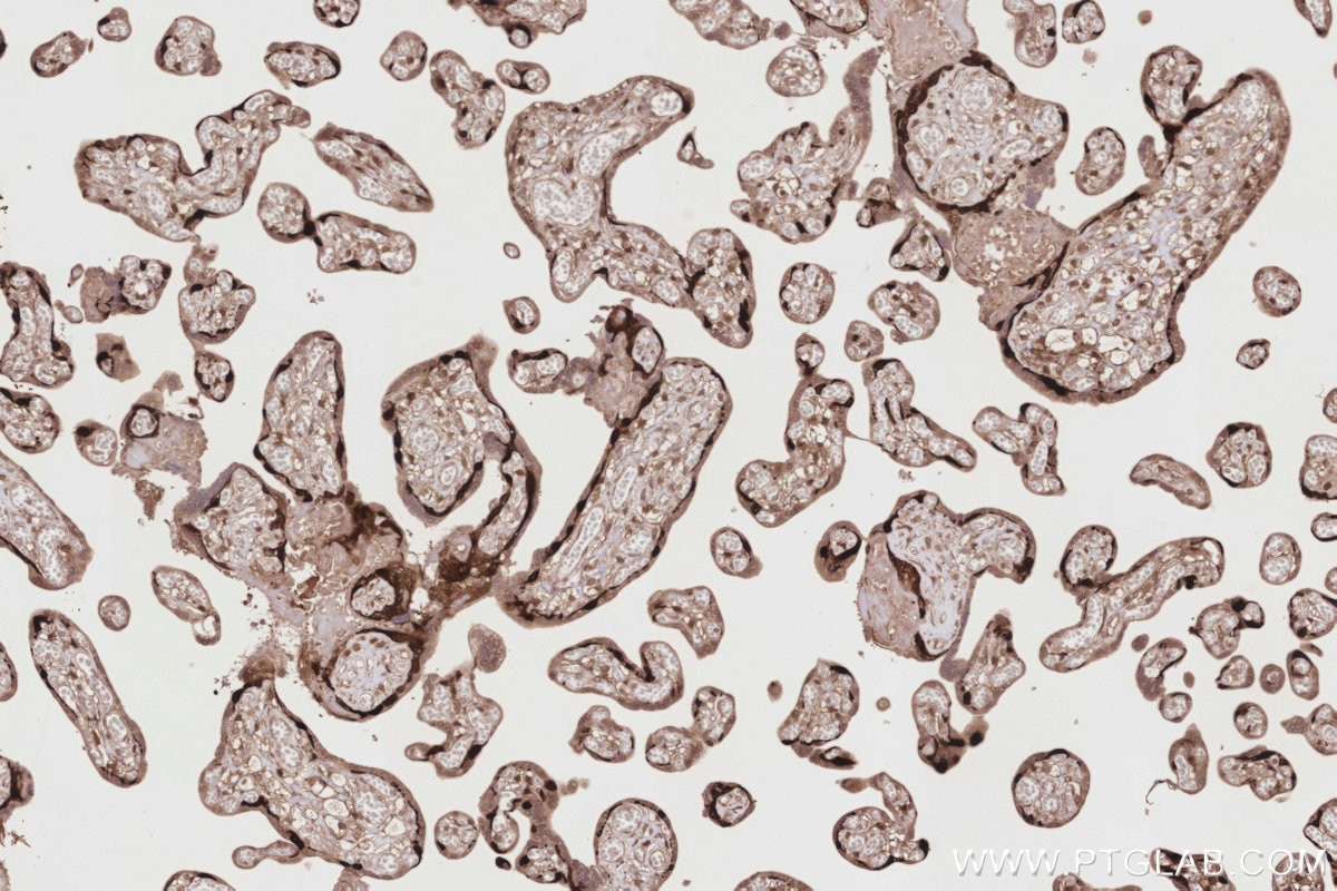 Immunohistochemistry (IHC) staining of human placenta tissue using DUSP9 Polyclonal antibody (26718-1-AP)