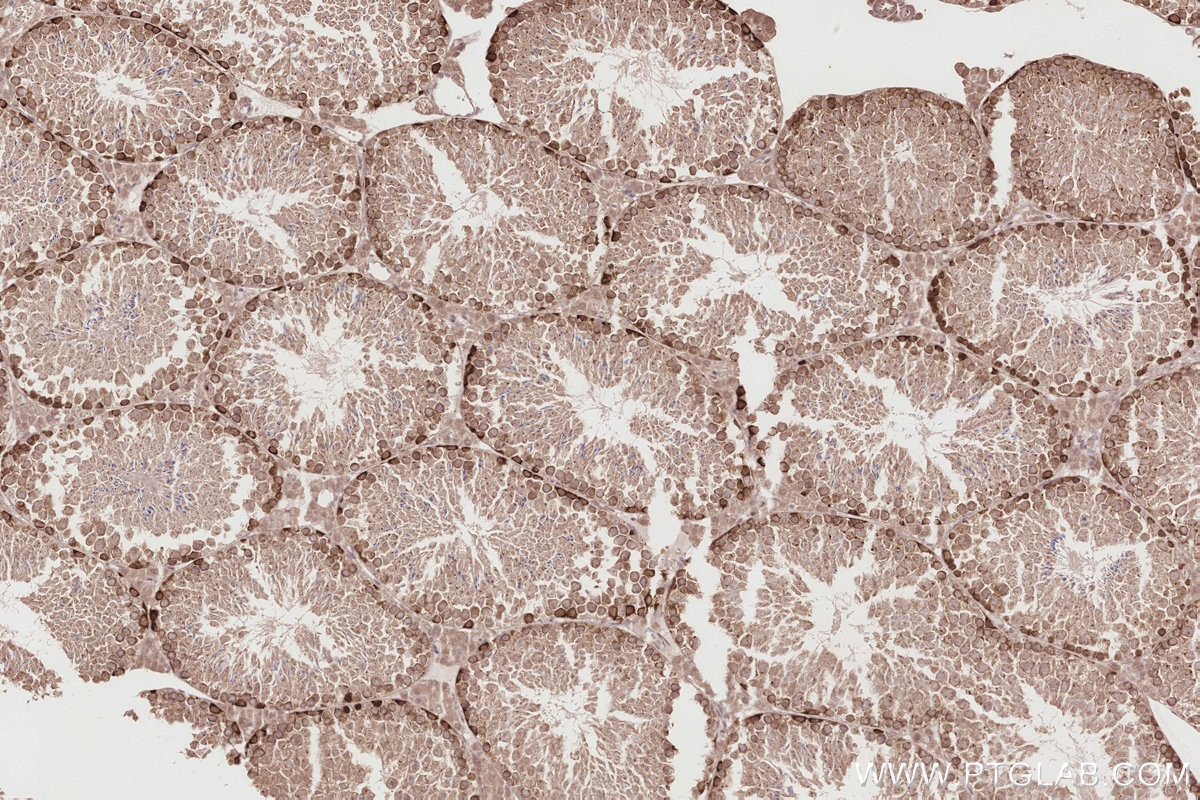 Immunohistochemistry (IHC) staining of mouse testis tissue using DUSP9 Polyclonal antibody (26718-1-AP)