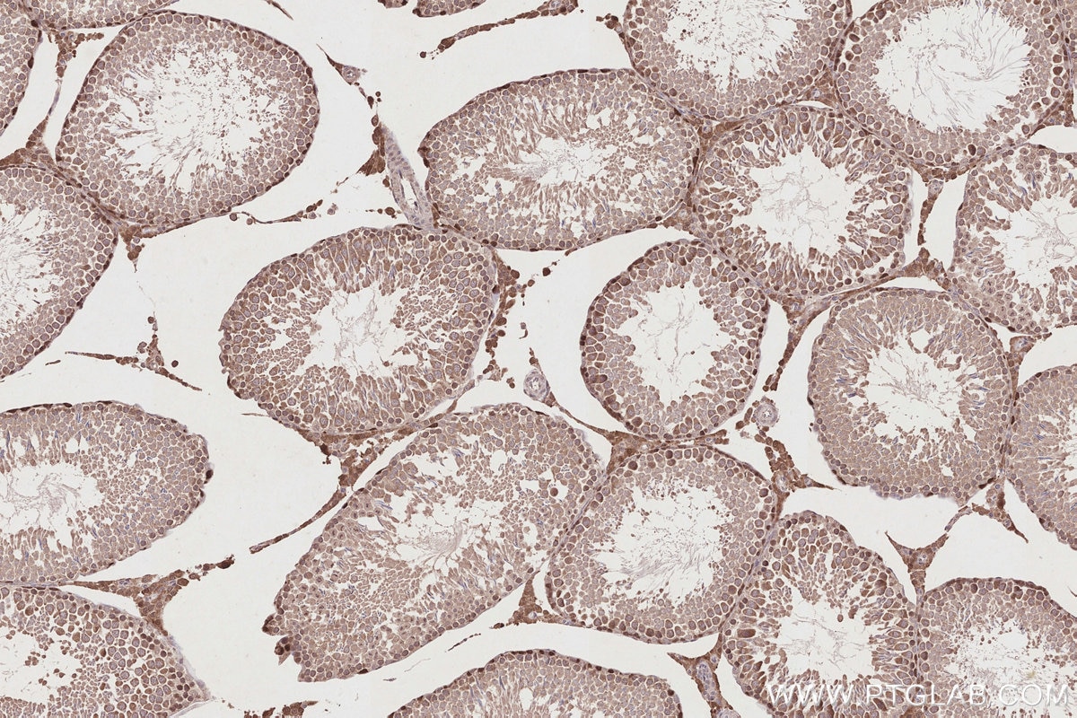 IHC staining of rat testis using 26718-1-AP Immunohistochemistry (IHC) staining of rat testis tissue using DUSP9 Polyclonal antibody (26718-1-AP)