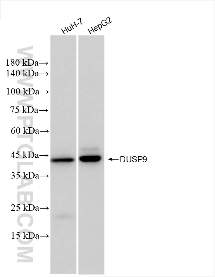 Western Blot (WB) analysis of various lysates using DUSP9 Recombinant antibody (86199-3-RR)