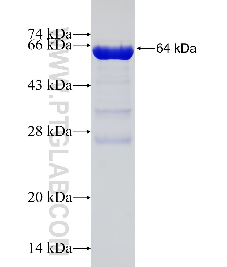 DUSP9 fusion protein Ag5881 SDS-PAGE