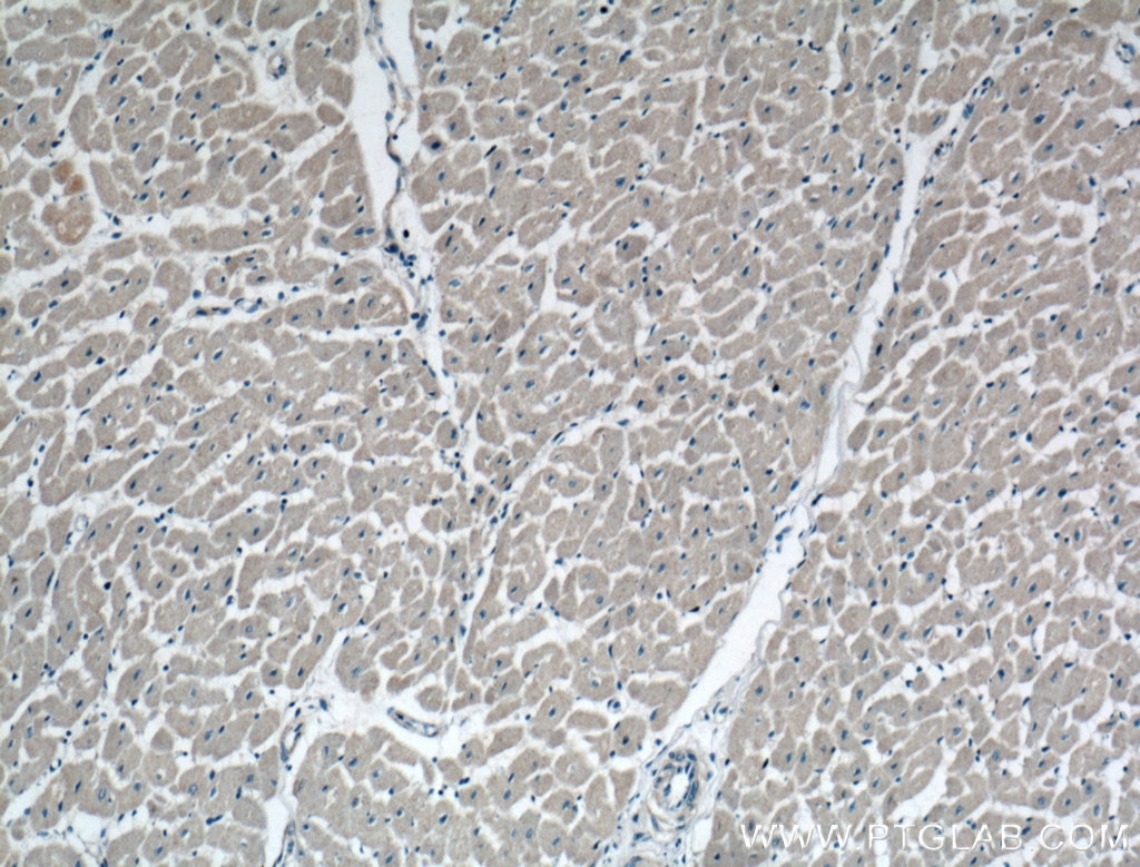 IHC staining of human heart using 13740-1-AP